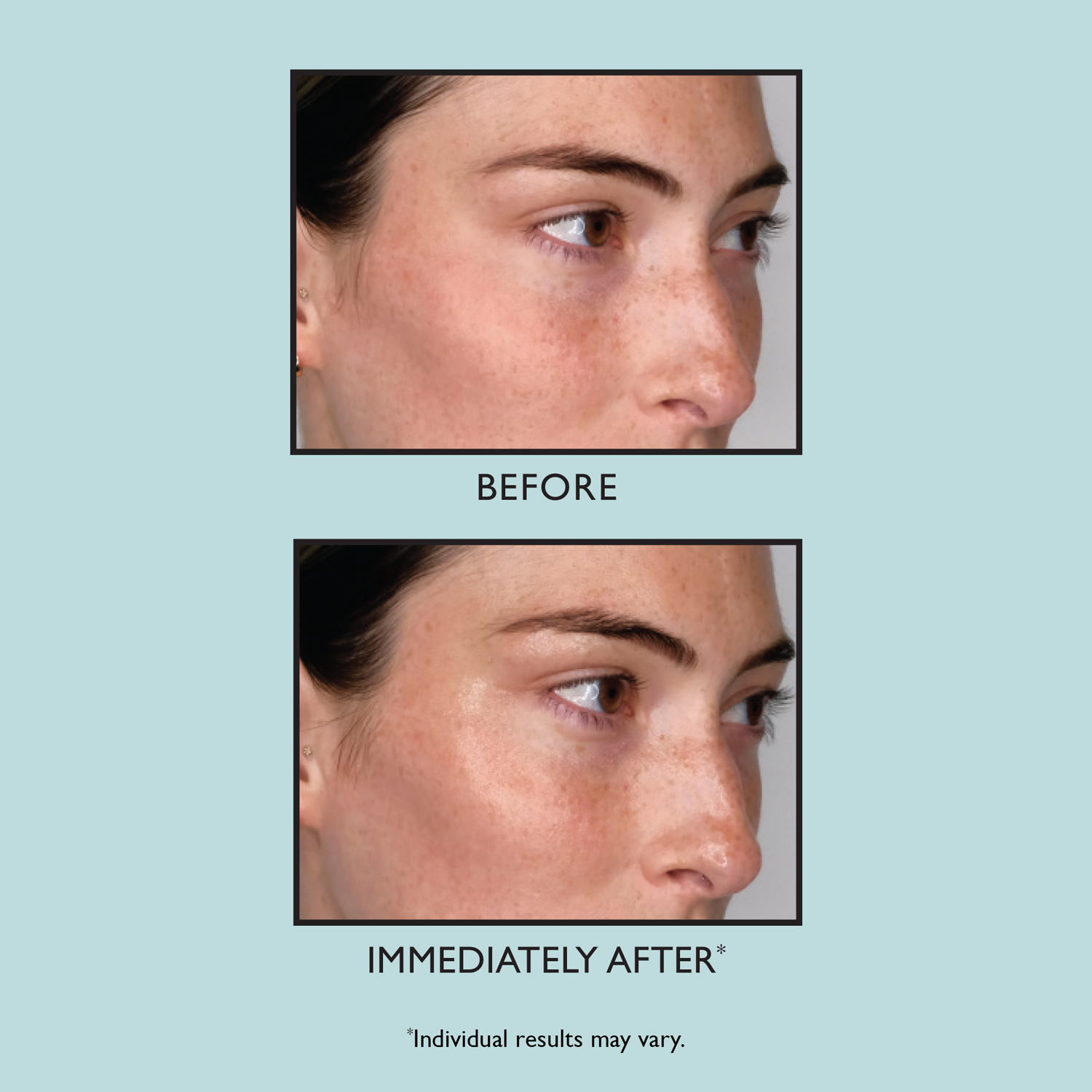 WATER DRENCH® HYALURONIC GLOW SERUM (SUERO FACIAL)